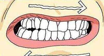 如何拔成人磨牙视频,轻松掌握成人磨牙拔除步骤详解